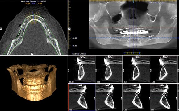 three dimensional cone beam radiography